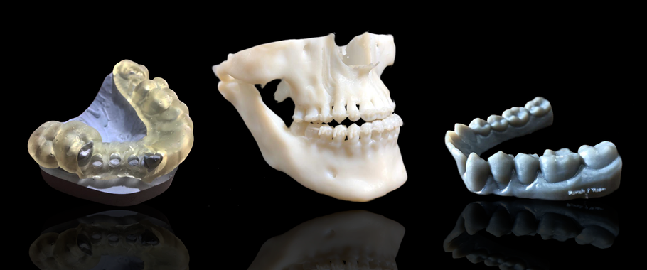 Odontología Digital: 5 formas en que la impresión 3D ha redefinido la industria dental