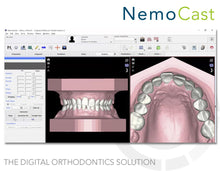 NemoCast - Software de Ortodoncia - TEQVITA PERÚ